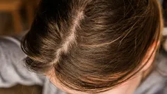 Därför känns håret fett redan dagen efter tvätt – vanorna som kan ge några extra fräscha dagar