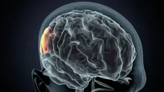 En detaljerad genomgång av vilka konsekvenser återkommande sömnbrist kan få.